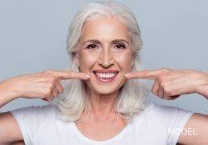 Smiling older lady pointing at teeth sf oral surgery