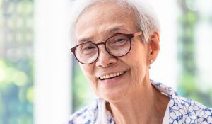 Senior female model for all on 4 dental implants